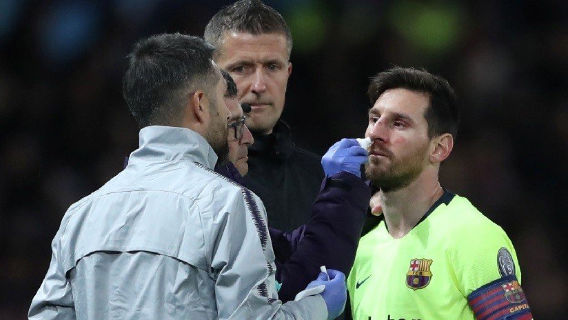 VIDEO, FOTOS: Messi sufre una herida facial tras un fuerte choque con Smalling del Manchester United