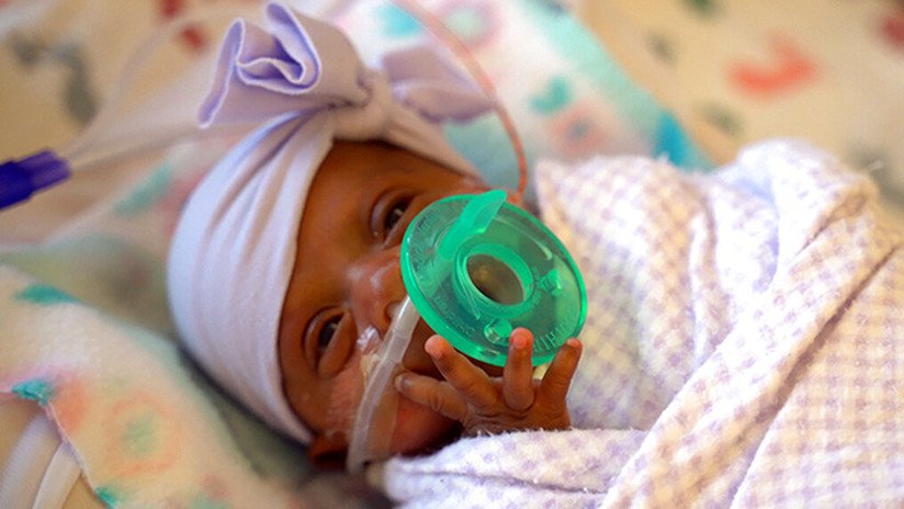 FOTOS: La bebé más pequeña del mundo pesó 245 gramos al nacer