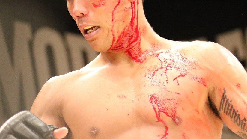 Suspenden un combate de artes marciales mixtas debido al exceso de sangre (VIDEO)