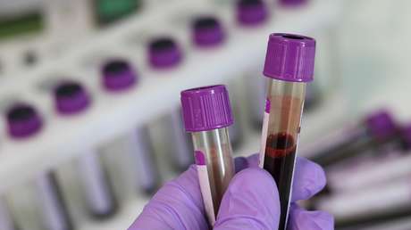 Nuevo procedimiento para detección del cáncer de ovario permitirá "salvar vidas y minimizar la necesidad de cirugía"