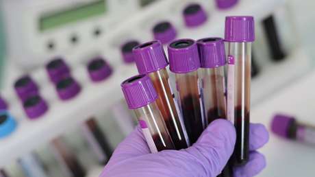 Conciben un análisis de sangre capaz de detectar el alzhéimer antes de que aparezcan sus síntomas clínicos