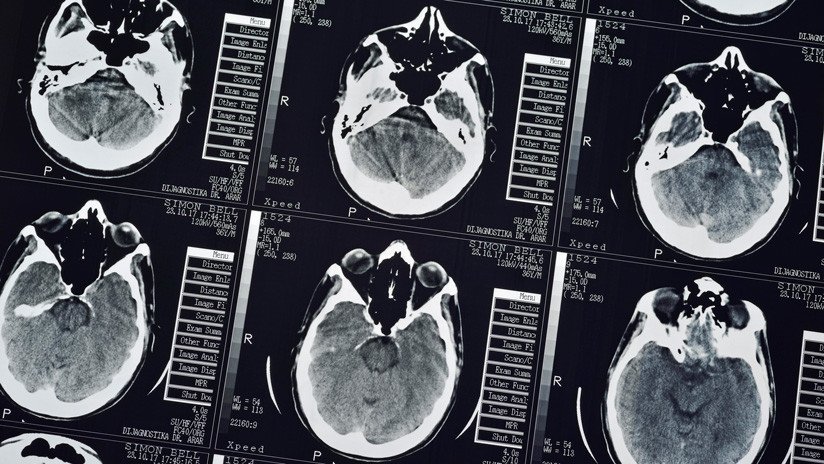Científicos afirman que analizar nuestros cerebros permitiría detectar a los homicidas