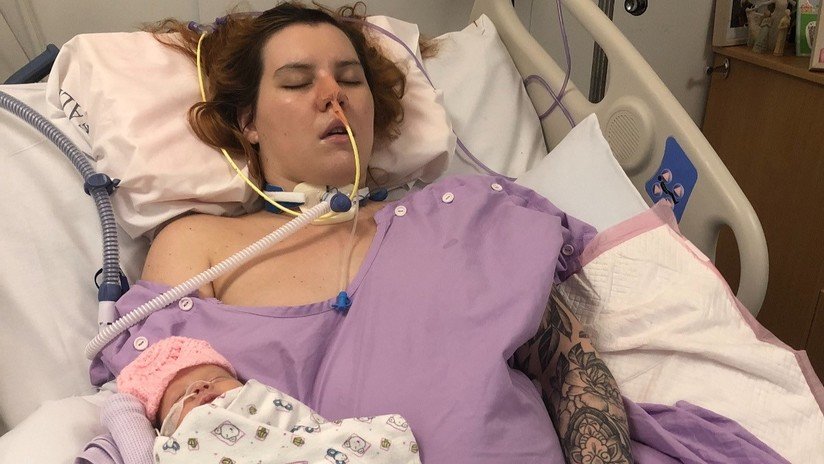 Una joven en coma da a luz a un bebé sano