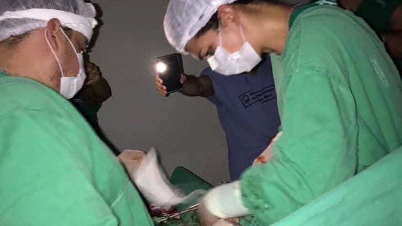 Médicos brasileños utilizan las linternas de sus celulares durante una cirugía en medio de un apagón eléctrico
