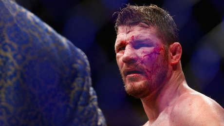 Un excampeón de la UFC se saca un 'ojo' durante una entrevista en vivo (VIDEO)