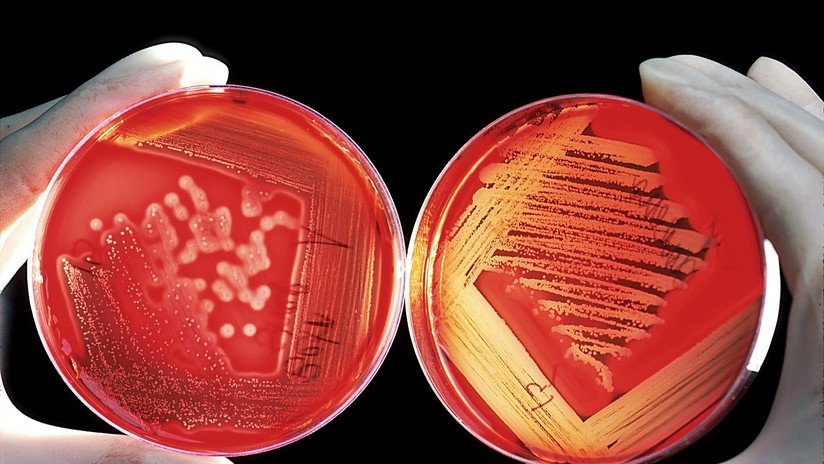 Alianza letal: dos cepas de bacterias 'comecarne' se combinan para causar una infección mortal