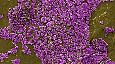 Se queja de dolor en los ojos y los médicos le descubren una infección de bacterias 'carnívoras'