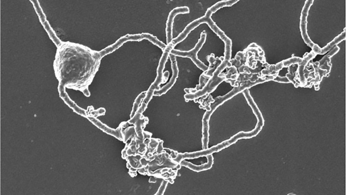 FOTO: Descubren en las profundidades de las costas de Japón un microbio que podría ayudar a explicar cómo surgió la vida compleja en la Tierra