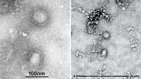 FOTO: Publican las primeras imágenes del mortal coronavirus originado en China