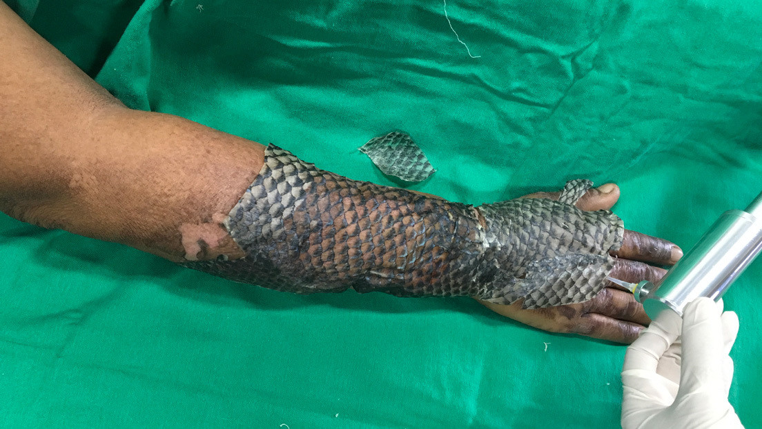 El pez que puede curar quemaduras y reconstruir vaginas (y que revolucionó la medicina en Brasil)