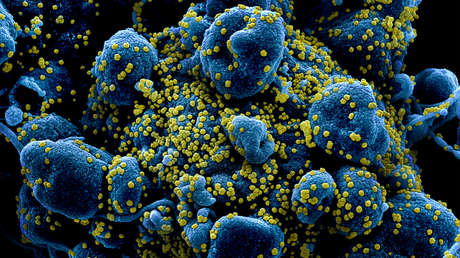 FOTOS: Captan al coronavirus atacando células humanas