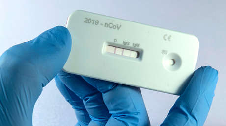 Expertos esperan que los test de anticuerpos permitan saber hasta cuándo es necesaria la cuarentena por coronavirus