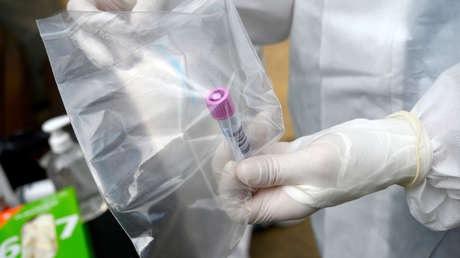 El Gobierno de España contrató por 17 millones de euros los 659.000 test defectuosos que fueron retirados