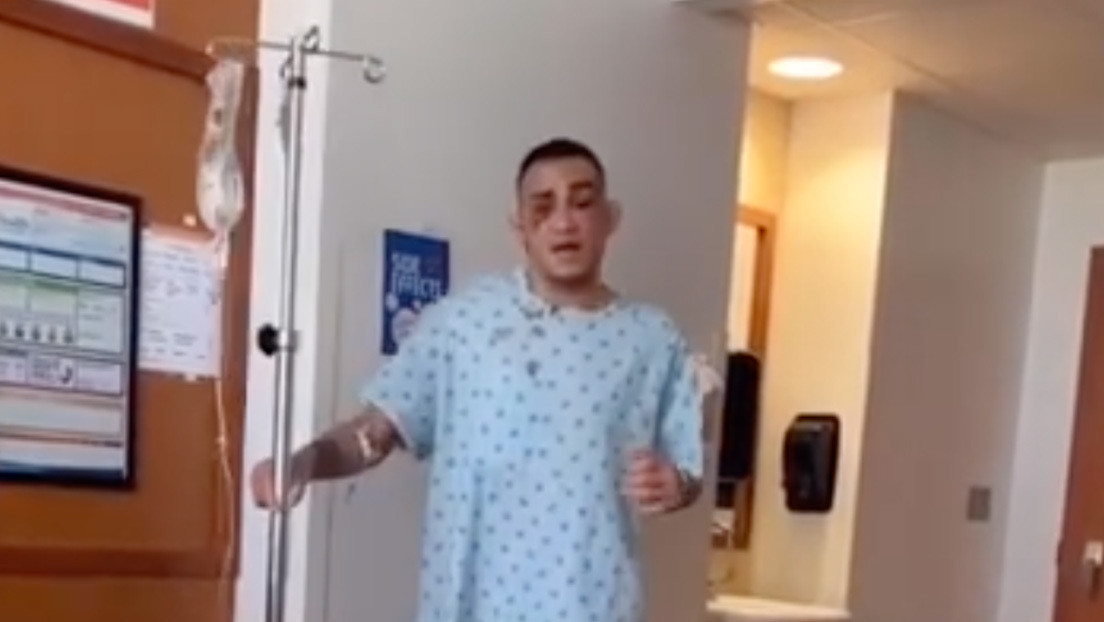 VIDEO: Tony Ferguson baila en el hospital tras perder un combate y recibir 100 golpes en la cabeza