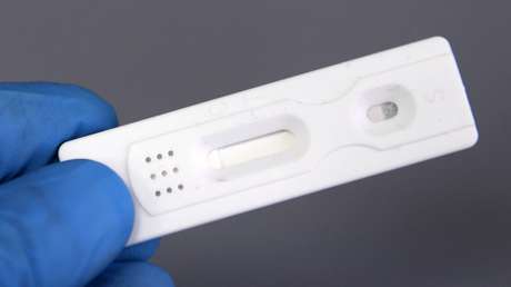 Rusia está dispuesta a suministrar test y medicamentos contra el covid-19 al mercado internacional