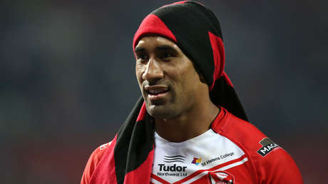 La grave fractura facial de un jugador de 'rugby' que agradeció por quedar con los dientes "intactos"