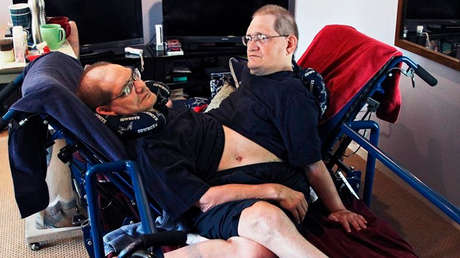 Los hermanos siameses más longevos del mundo mueren a los 68 años