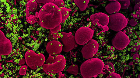 Prueban con éxito un fármaco capaz de reducir "considerablemente" el riesgo de desarrollar cuadros severos de coronavirus