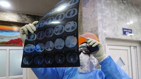 Un estudio revela una nueva causa de mortalidad en los enfermos de covid-19