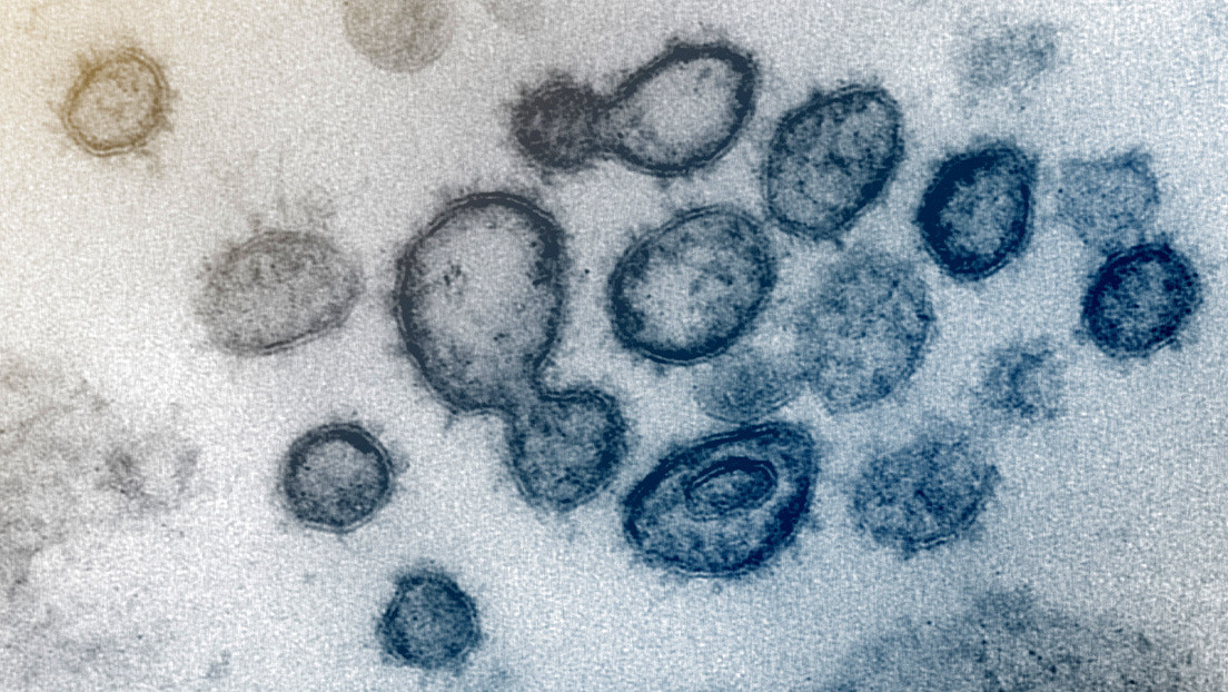 Nuevas imágenes revelan en detalle cómo infecta el coronavirus las células pulmonares