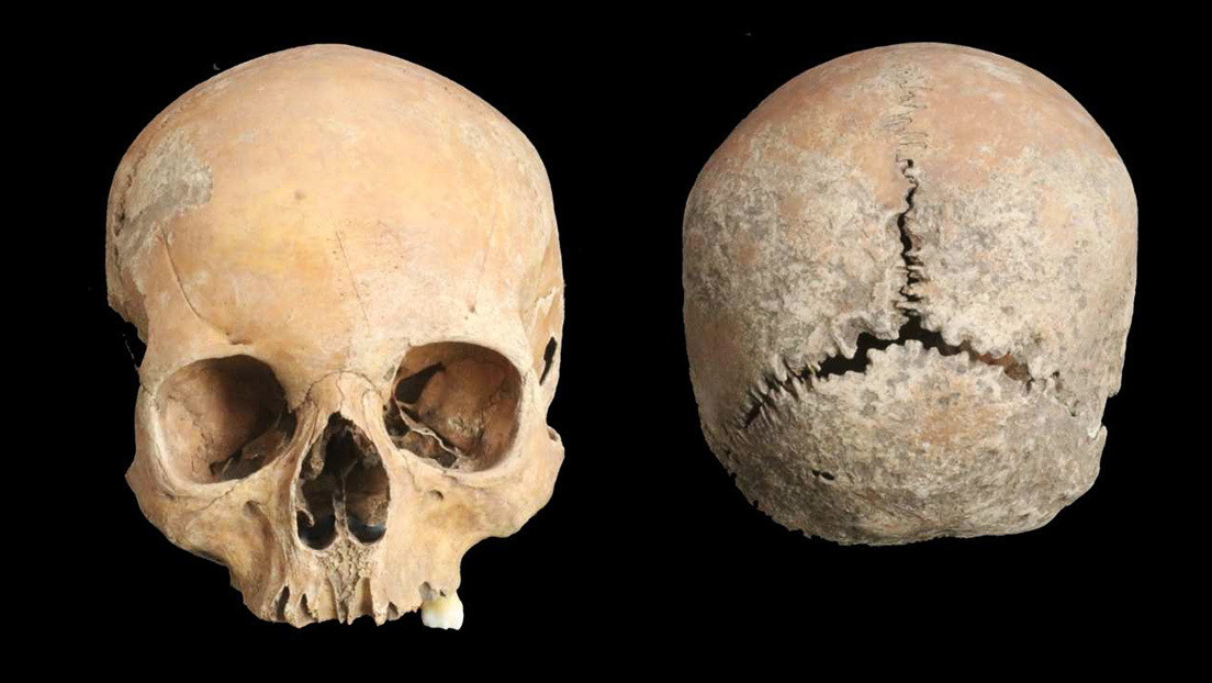 Documentan el caso más antiguo de mutilación facial como castigo en la Inglaterra anglosajona