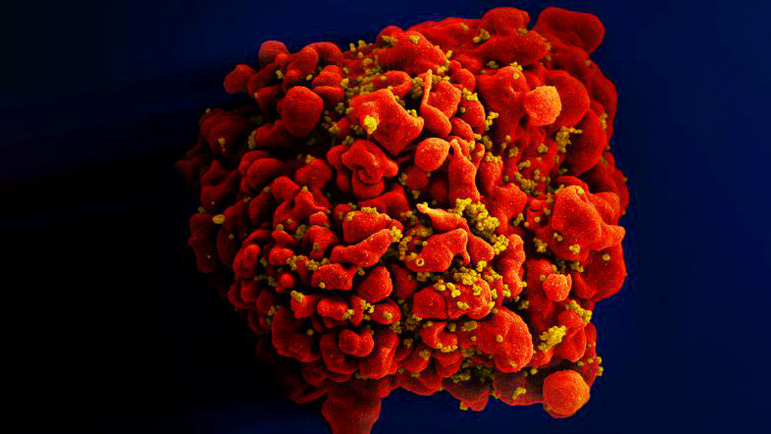 Recrean en un laboratorio los primeros pasos del VIH cuando ataca un organismo humano