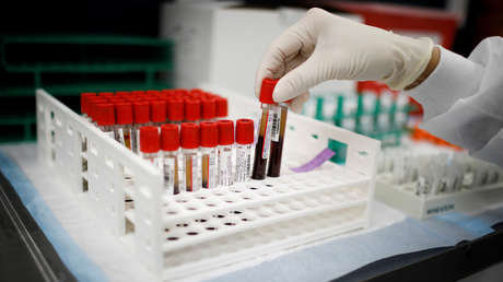 Estudios sugieren que las personas de un cierto grupo sanguíneo pueden tener menor riesgo de contraer covid-19