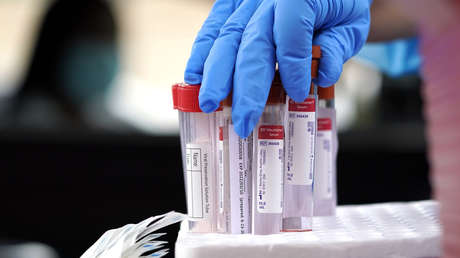 Una paciente asintomática con coronavirus permaneció contagiosa durante 70 días y sus pruebas fueron positivas 105 días