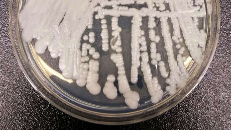 Brasil reporta su primer posible caso de infección con el peligroso hongo 'Candida auris', resistente a los medicamentos