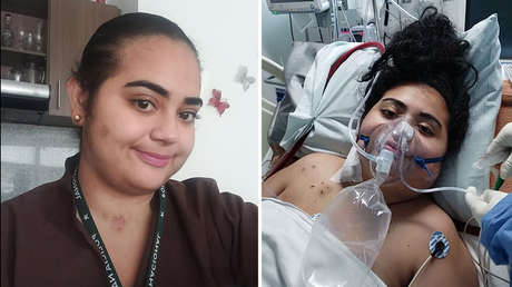 Una doctora colombiana tuvo que aprender de nuevo a hablar y a escribir tras pasar más de dos meses en UCI por covid-19