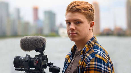 VIDEO: Un adolescente comparte en TikTok cómo fue vivir sin un pedazo de cráneo tras sufrir un accidente