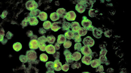 Una ameba 'comecerebros' expandió su hábitat hacia el norte en EE.UU. durante las últimas décadas