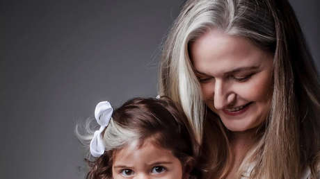 Una niña brasileña nace con canas debido a una rara condición genética (y su mamá la convierte en estrella de las redes)