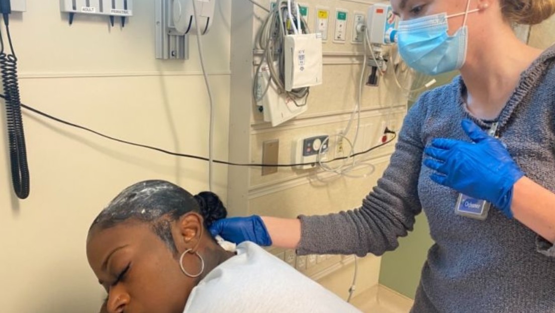 "Mala, mala, mala idea": Una bloguera usa pegamento en lugar de laca para el cabello e ingresa al hospital tras no poder quitárselo durante un mes