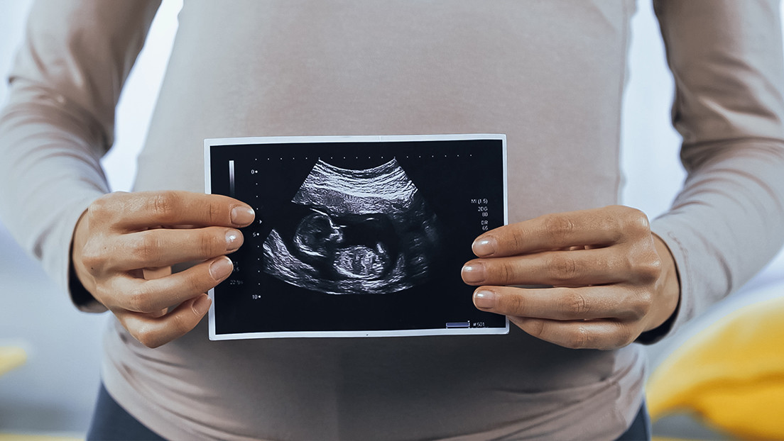 Una pequeña con una rara condición médica nace con el feto sin vida de su gemelo en el interior de su estómago