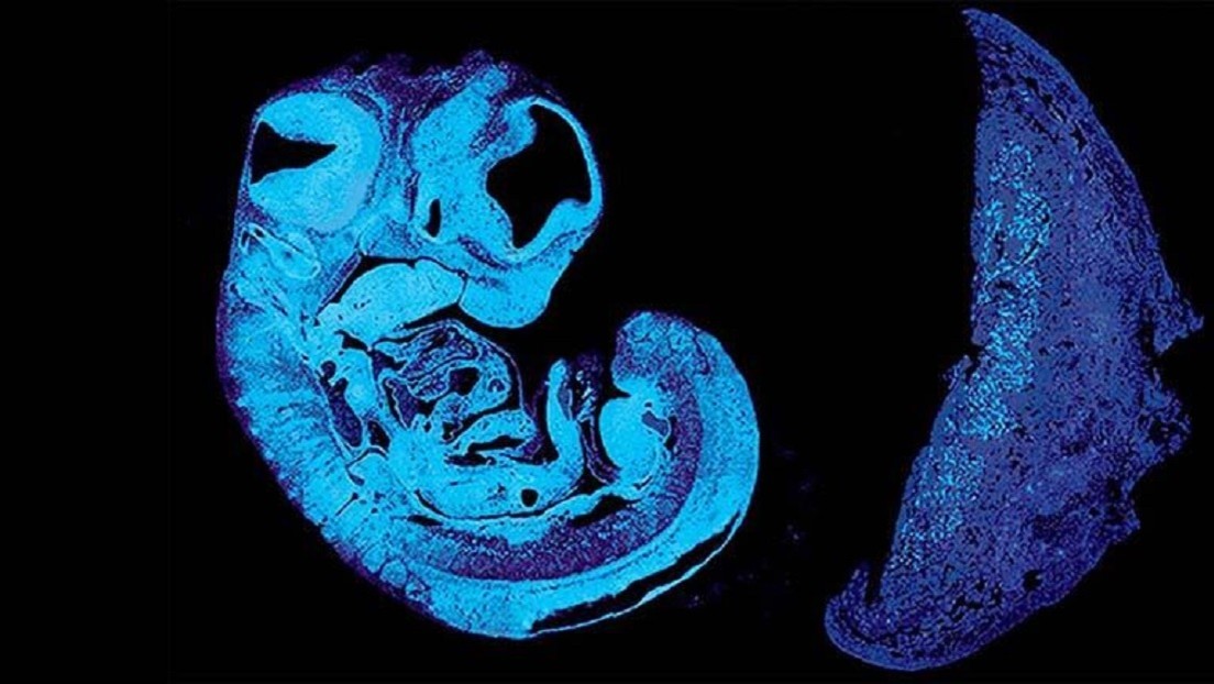 La primera "batalla de los sexos" comienza en el útero: los genes del padre y la madre del feto se pelean por comida, asegura un nuevo estudio