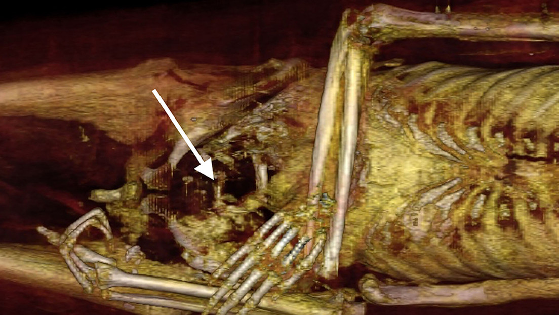 La primera 'desenvoltura' digital de la momia de Amenhotep I halla dos dedos en su vientre