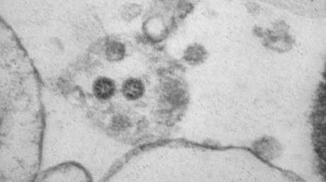 El laboratorio ruso creador de la vacuna EpiVacCorona publica una microfoto de la variante ómicron del coronavirus