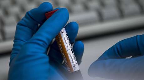 El laboratorio de la AMA "no sabía que debía acelerar el análisis" de la muestra de Valíeva