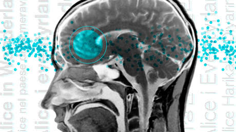 Descubren una "red lingüística universal" tras analizar imágenes cerebrales de hablantes de 45 idiomas