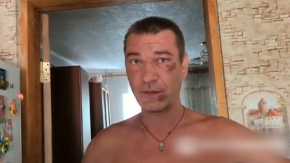 VIDEO: Un habitante de Lisichansk cuenta cómo fue torturado en 2014 por militantes ucranianos