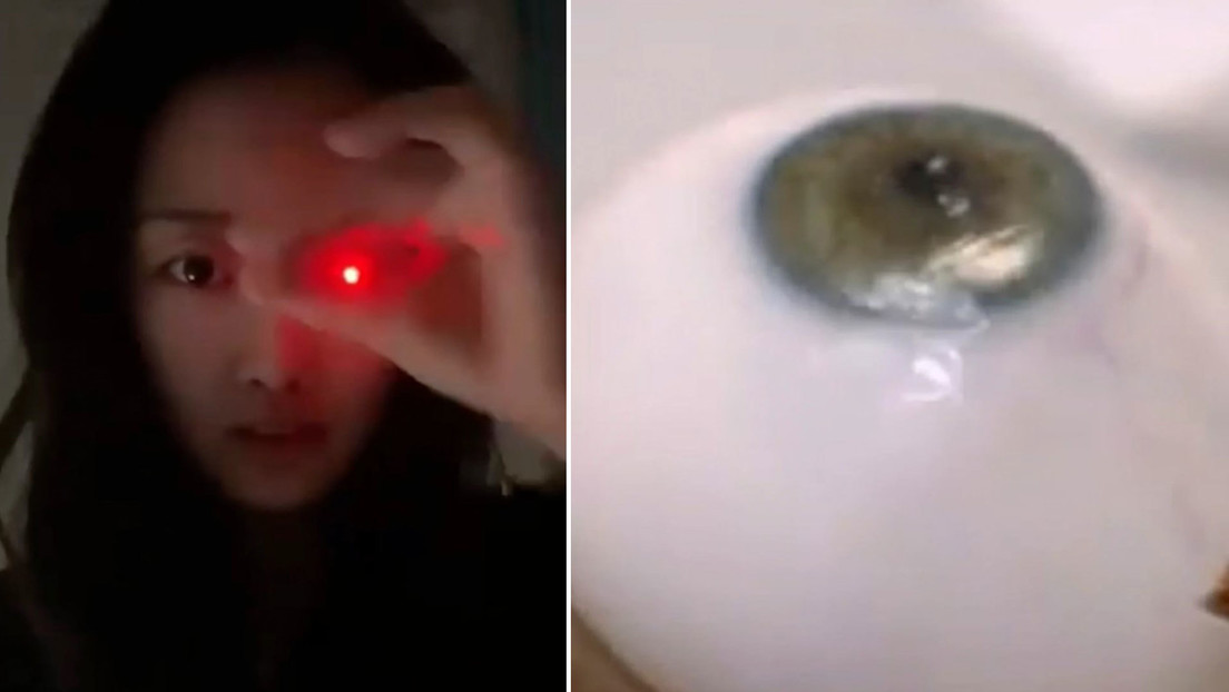 Mujer que perdió un ojo desarrolla una prótesis brillante 'a lo Terminator'