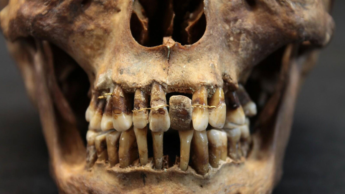 Arqueólogos descubren un secreto dorado en la boca de una aristócrata del siglo XVII
