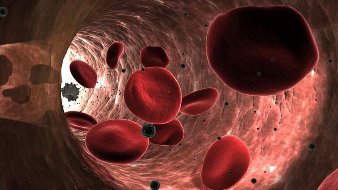 Descubren por primera vez microplásticos en los vasos sanguíneos humanos
