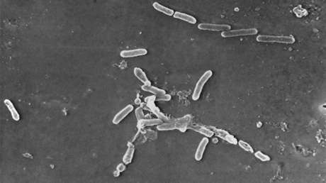 Sacan del mercado una marca de gotas para ojos por brote de una bacteria que puede causar ceguera