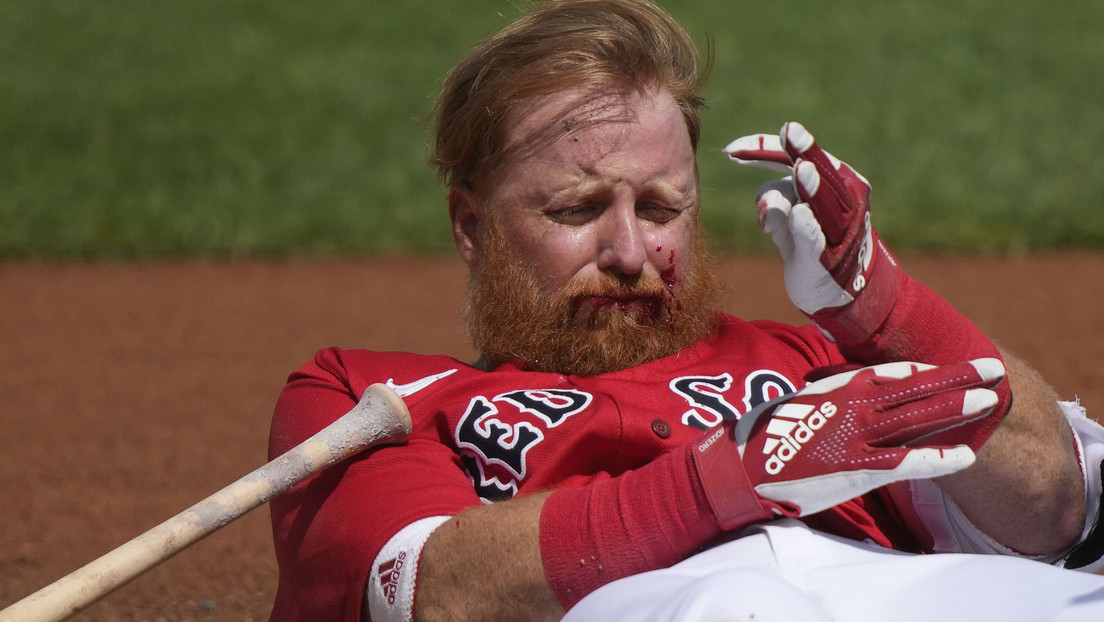 VIDEO: Un fuerte pelotazo en el rostro manda a un beisbolista de los Boston Red Sox al hospital