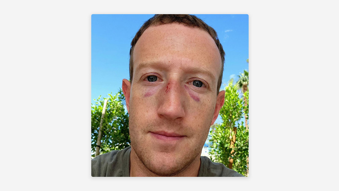 Mark Zuckerberg aparece en una selfi con moretones en los ojos y heridas en la nariz