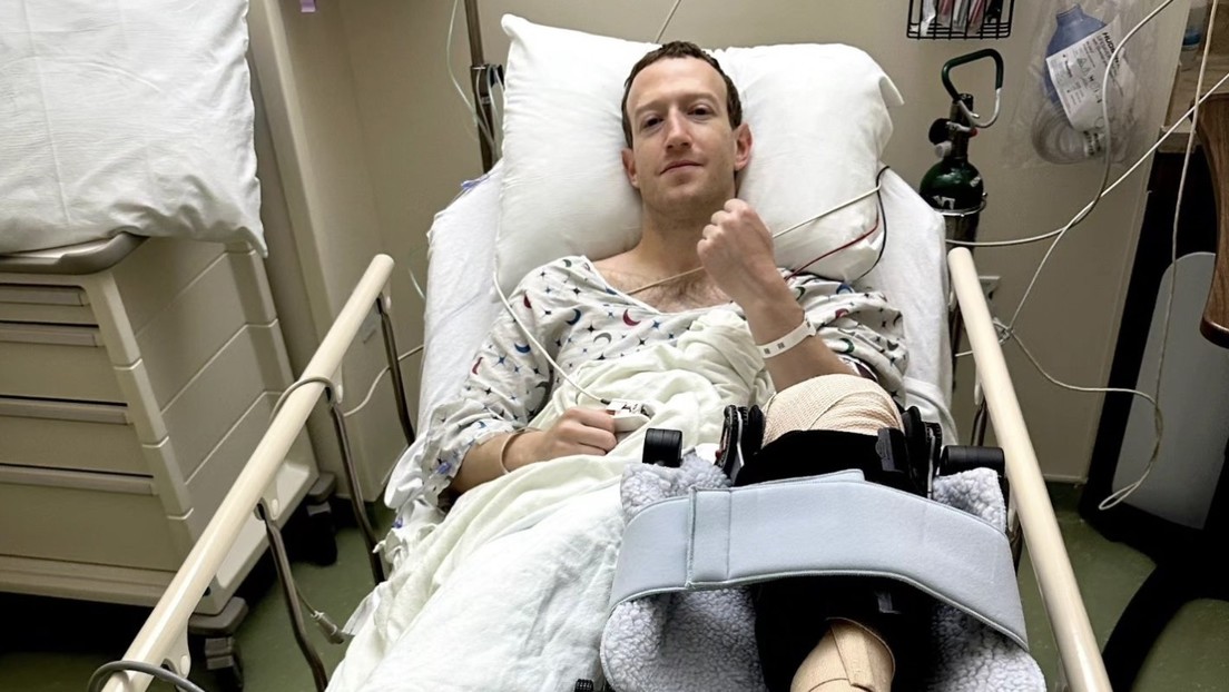 Zuckerberg es sometido a una operación tras lesionarse durante un entrenamiento de MMA