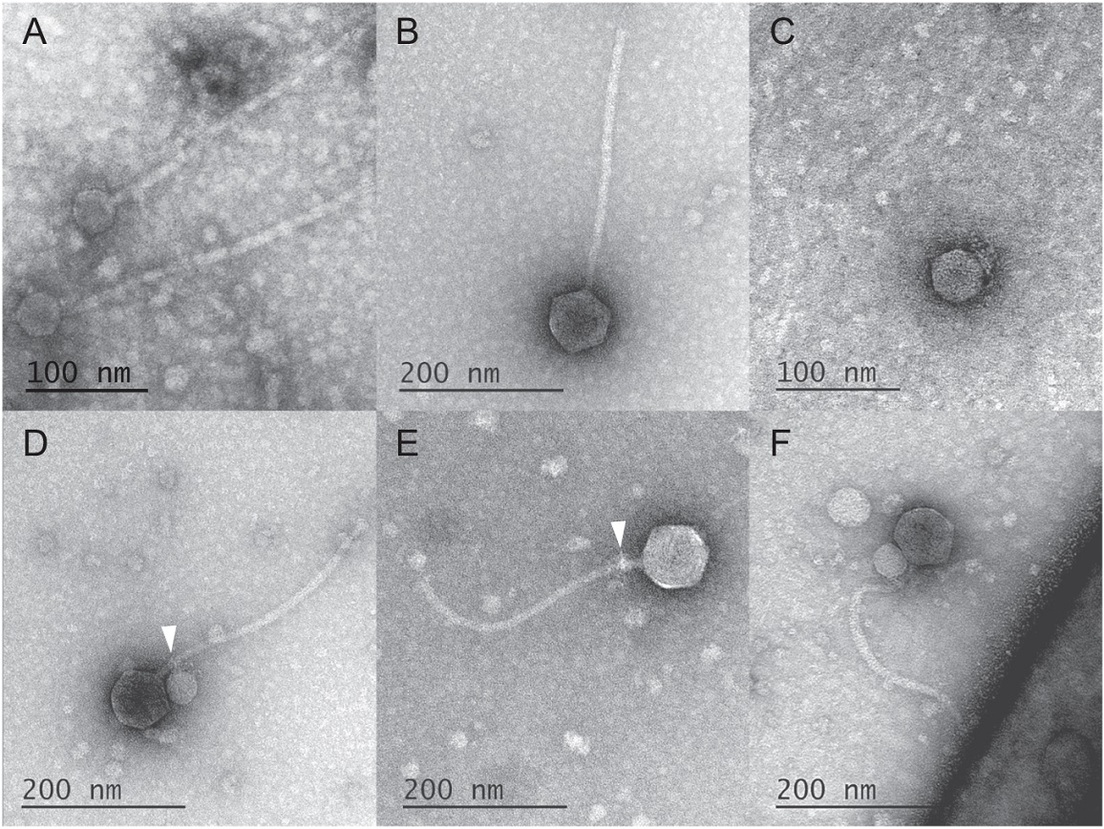 6544678a59bf5b38bc1bcc38 Un equipo de investigación hace un curioso descubrimiento observan por primera vez un virus adherido a otro