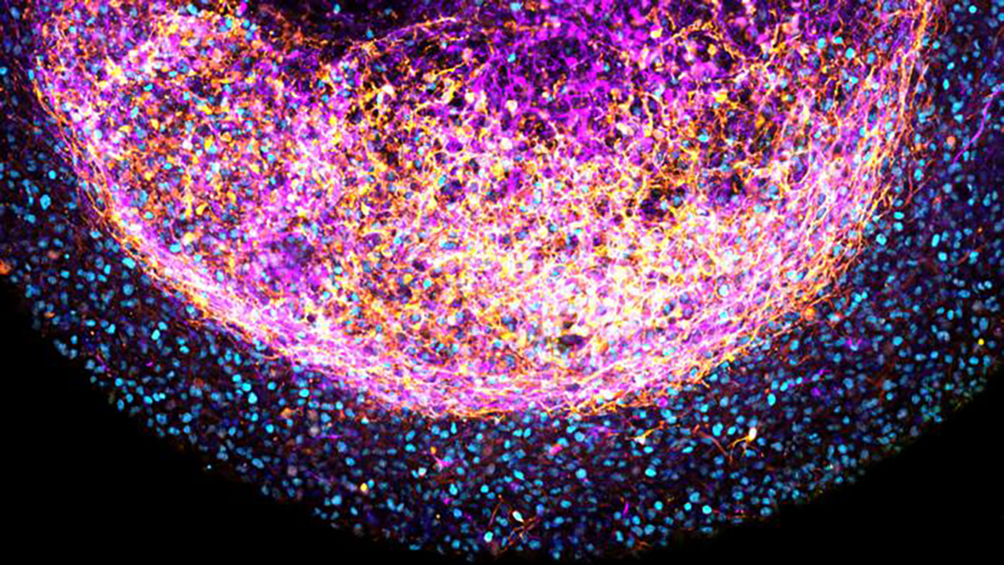 'Minicerebro' humano con tejido real podría revolucionar la investigación neurológica